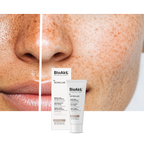 BioAké Skinclar Depigmentujący Krem do Twarzy | 50 ml